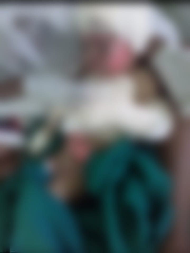 Beb&ecirc; sofreu queimaduras graves pelo corpo/Foto:Divulga&ccedil;&atilde;o