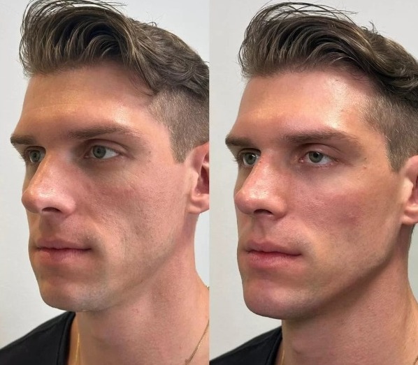 Antes e depois de Cristian - Fotos: Divulga&ccedil;&atilde;o