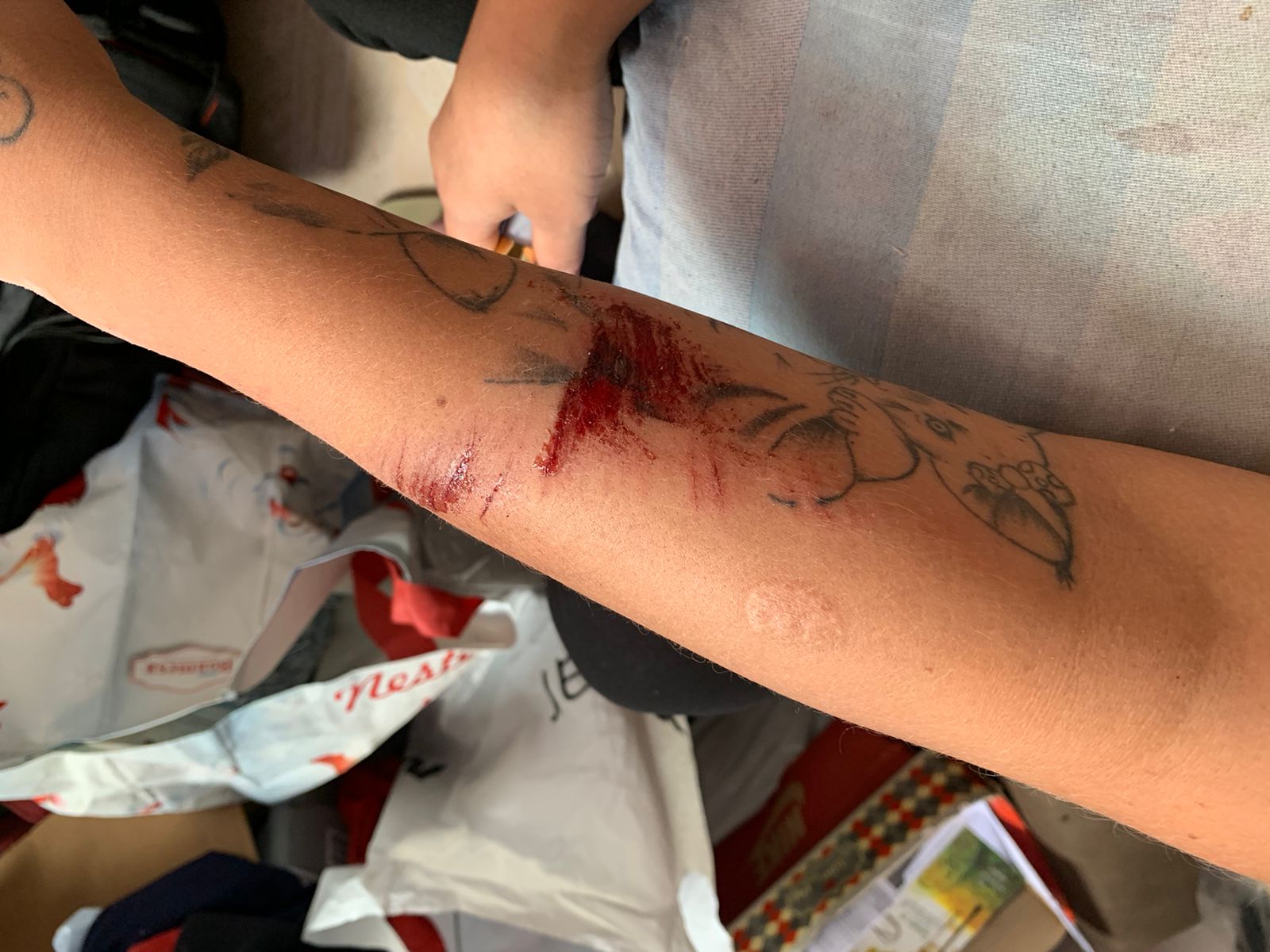 Moradora ficou ferida / Foto: Caio Guarlotte / Portal do Holanda