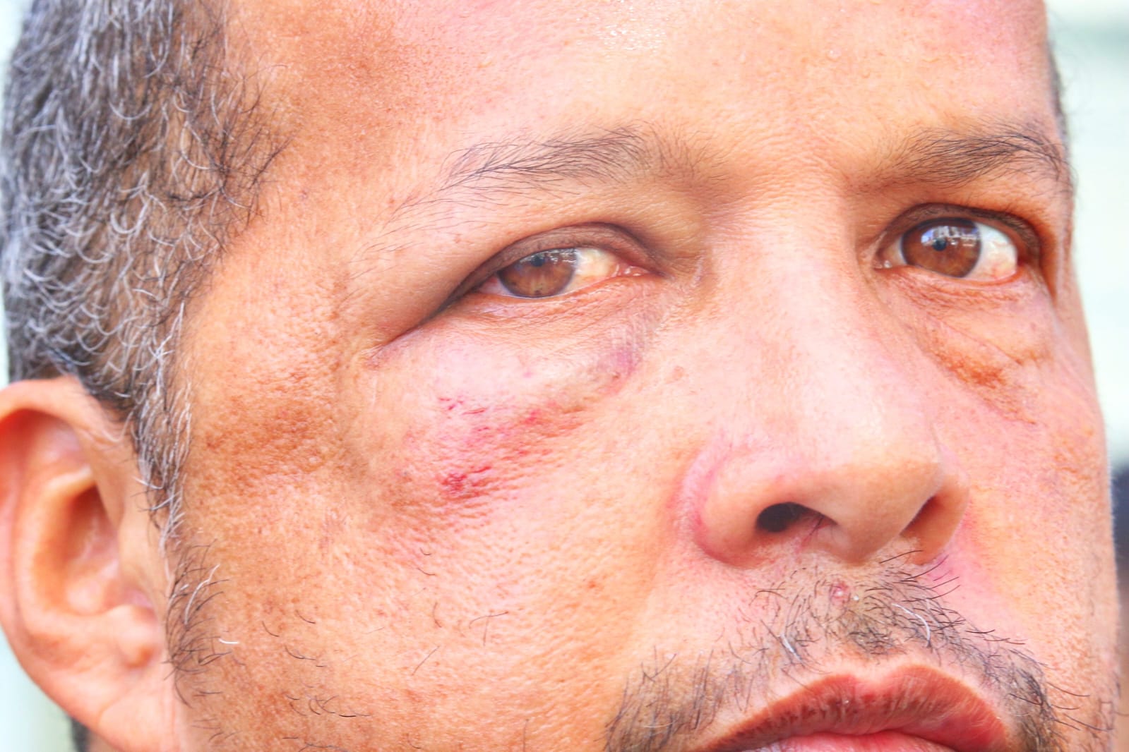 Foto: Jander Robson/Portal do Holanda