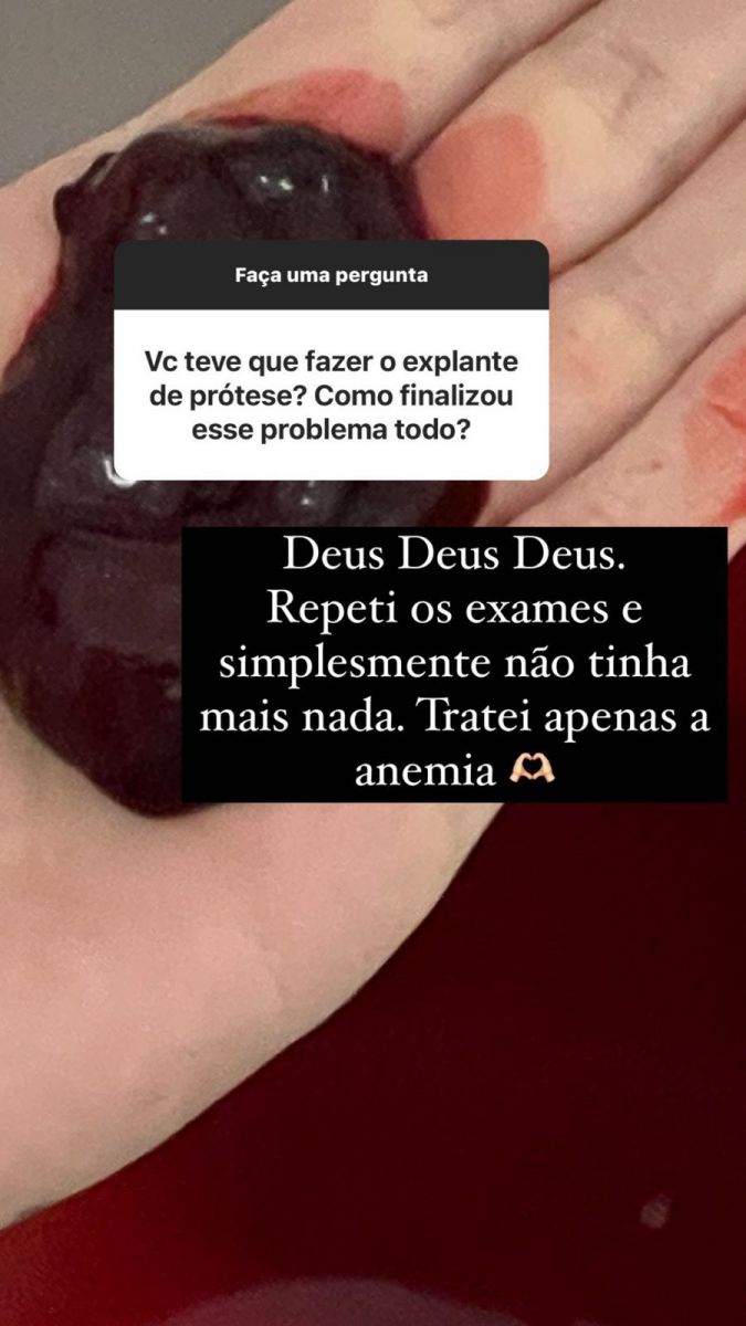 Imagem: Reprodu&ccedil;&atilde;o/Instagram