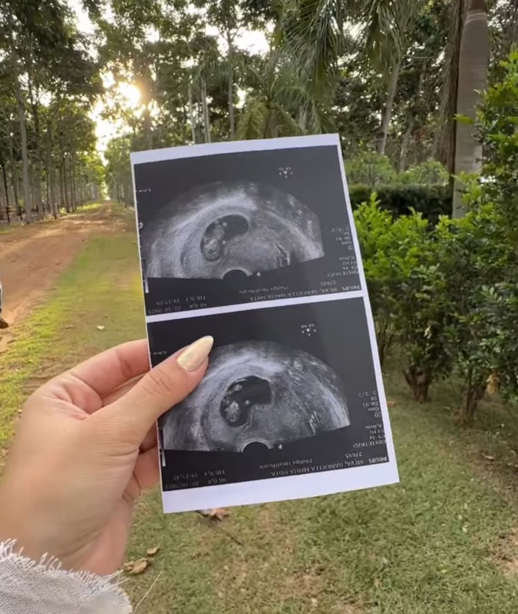 Imagens: Reprodu&ccedil;&atilde;o/Instagram