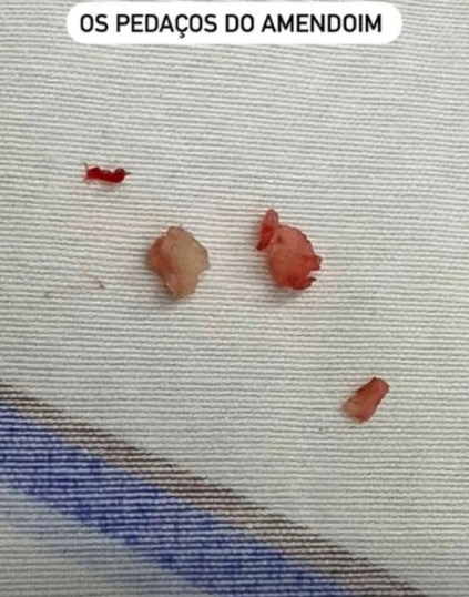 Imagem: Reprodu&ccedil;&atilde;o/Instagram