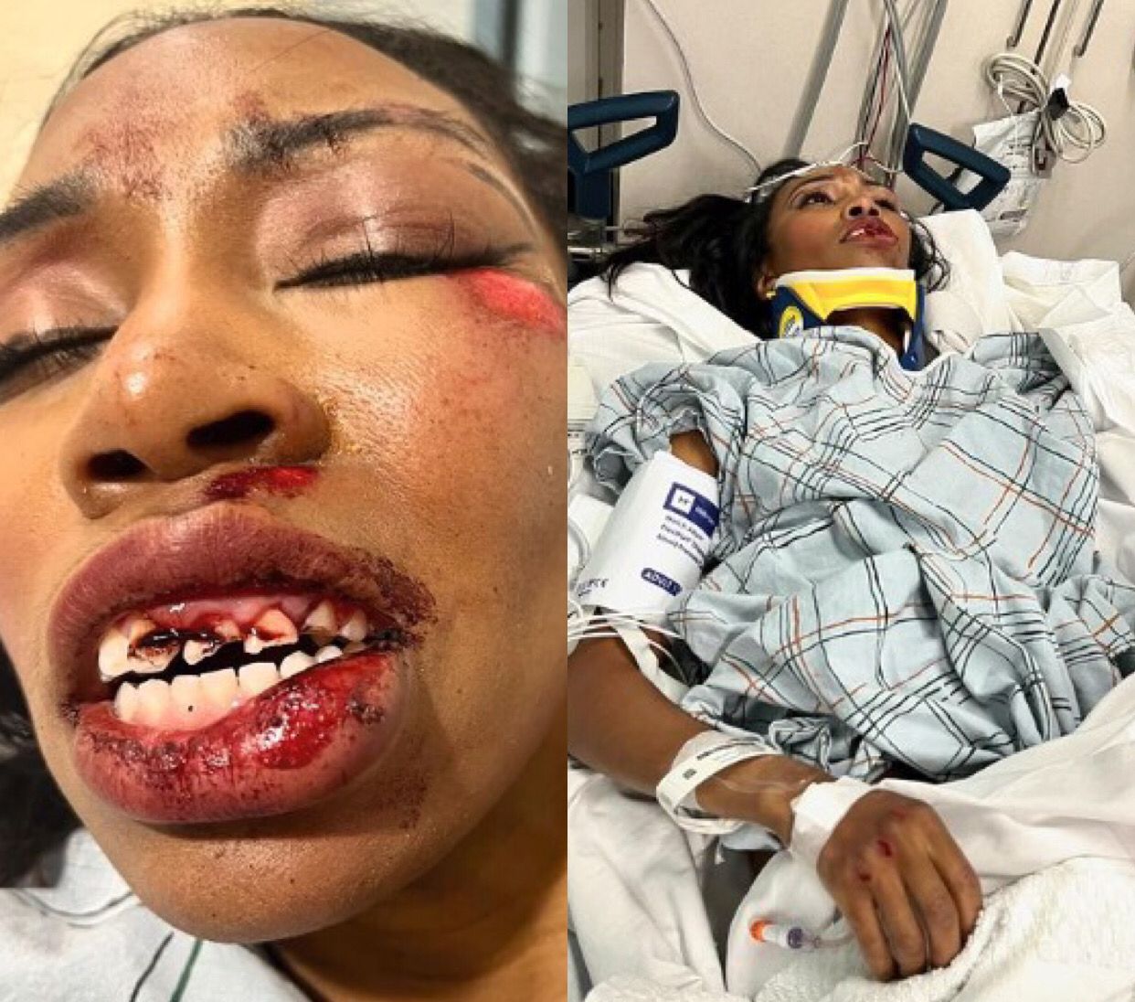 Imagens: Reprodu&ccedil;&atilde;o/Instagram