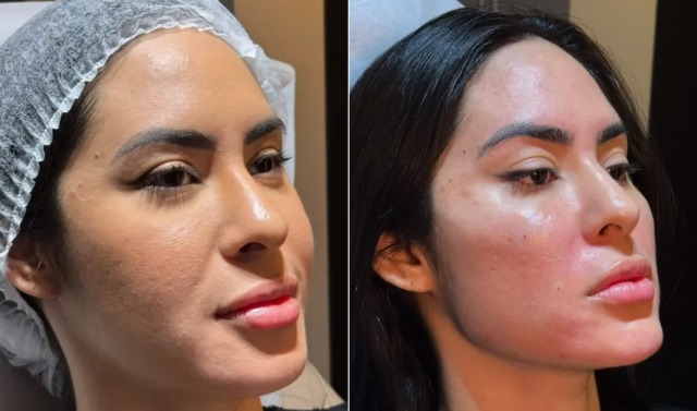 Antes e depois - Foto: Reprodu&ccedil;&atilde;o/Instagram