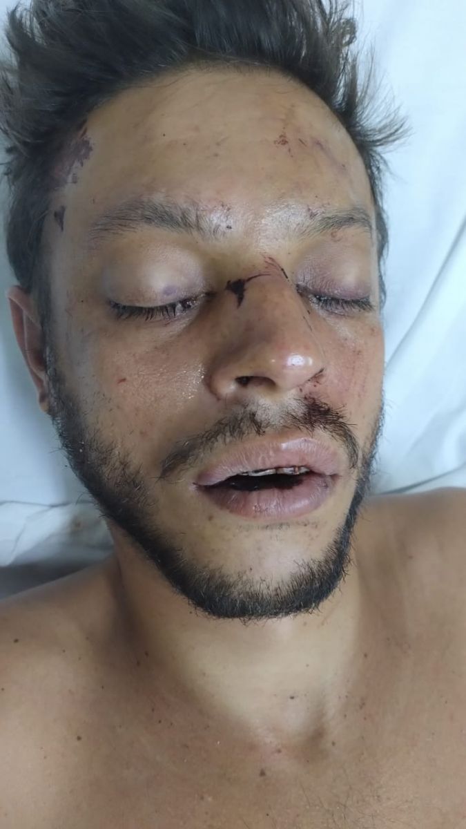 Foto: Divulga&ccedil;&atilde;o SES-AM