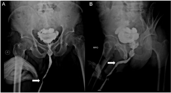 Foto: Divulga&ccedil;&atilde;o Hospital Acad&ecirc;mico Geral Soetomo