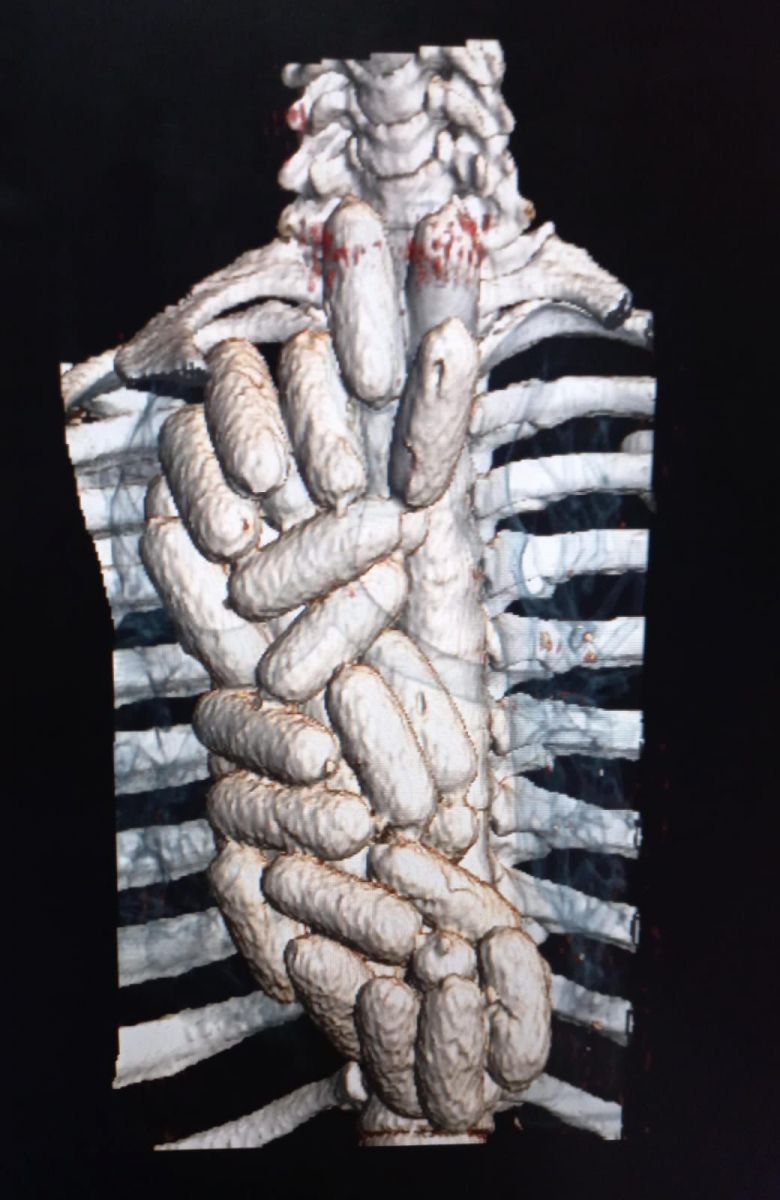 Foto: Divulga&ccedil;&atilde;o