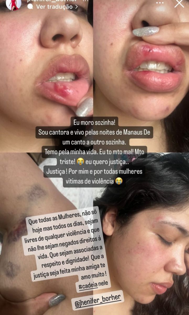 Imagens: Reprodu&ccedil;&atilde;o/Instagram