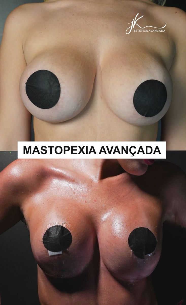 Imagens: Reprodu&ccedil;&atilde;o/Instagram