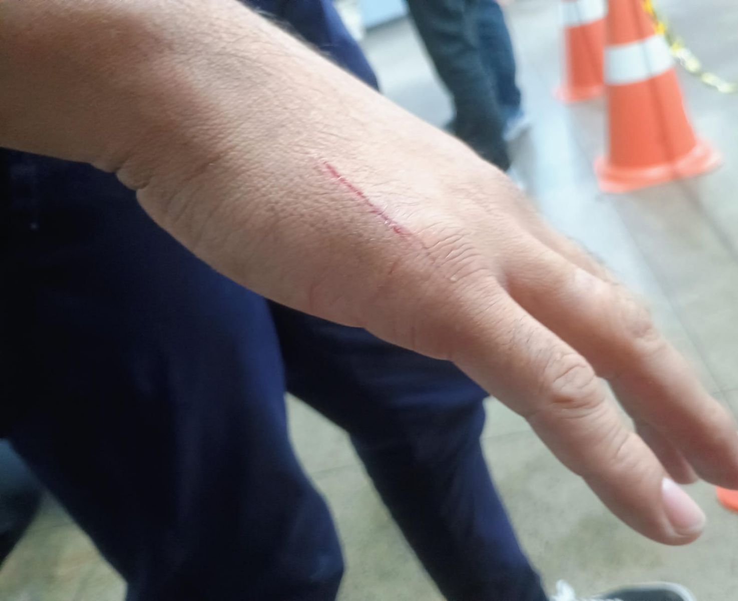 M&atilde;o de passageiro discada pela faca de um dos assaltantes. - Foto: Jander Robson / Portal do Holanda