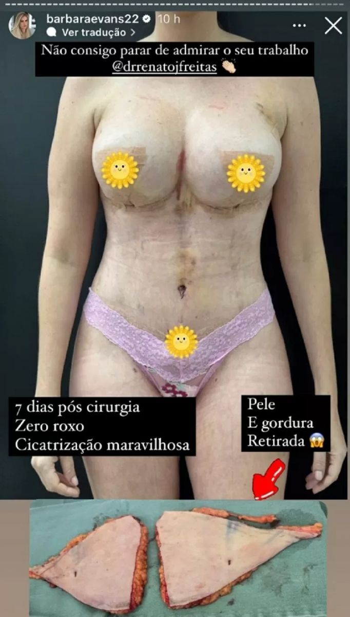 Foto: Reprodu&ccedil;&atilde;o Instagram