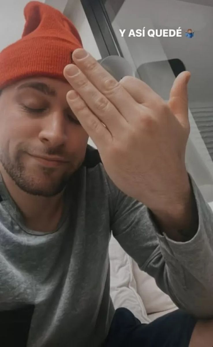 Gonzalo Sorbo brincou dizendo que o dedo foi decepado. - Foto: Reprodu&ccedil;&atilde;o/Instagram