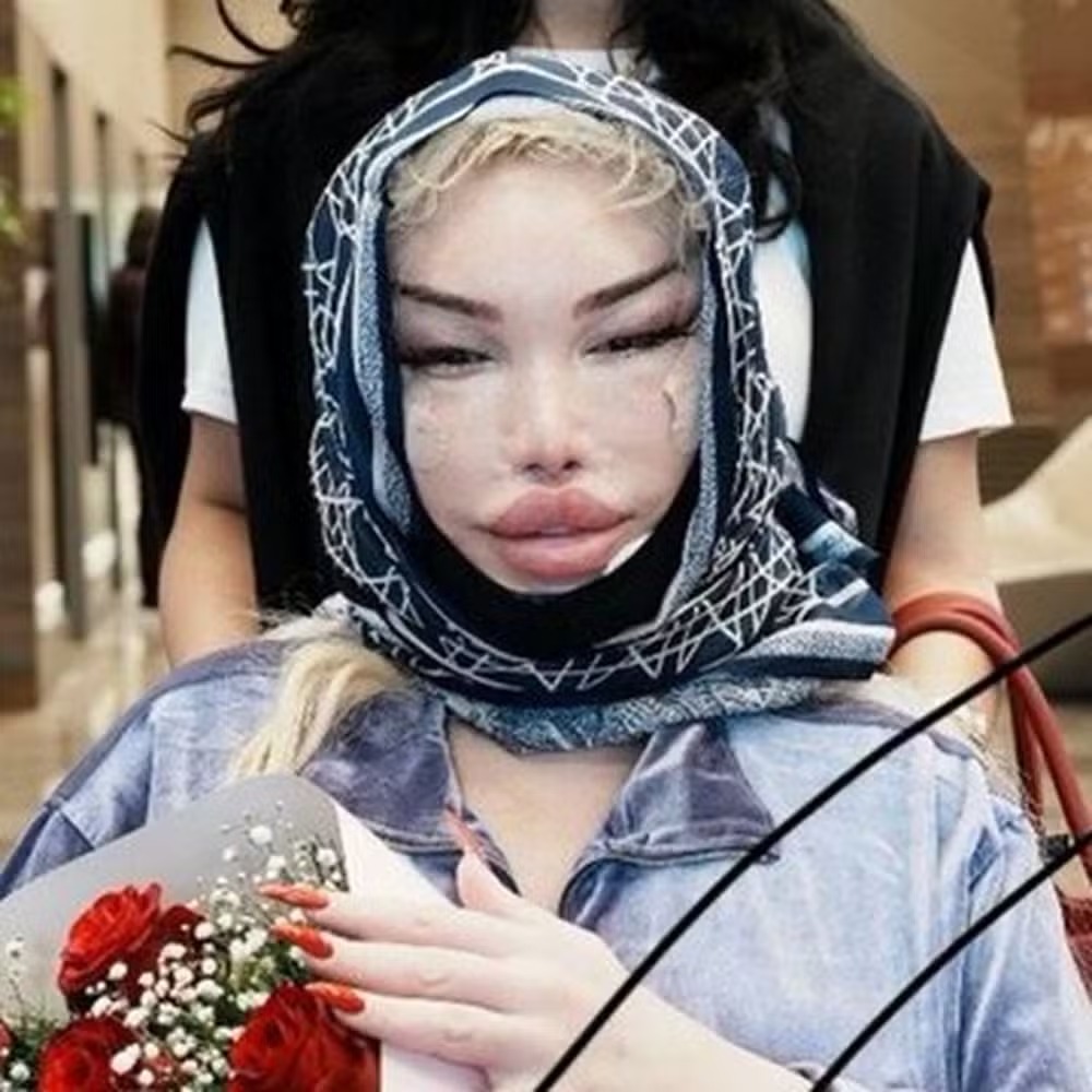 Foto: Reprodu&ccedil;&atilde;o X