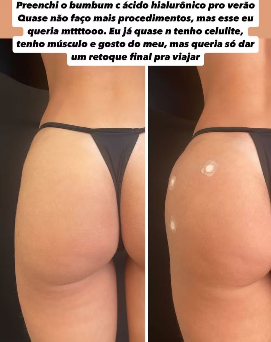 Foto: Reprodu&ccedil;&atilde;o Instagram