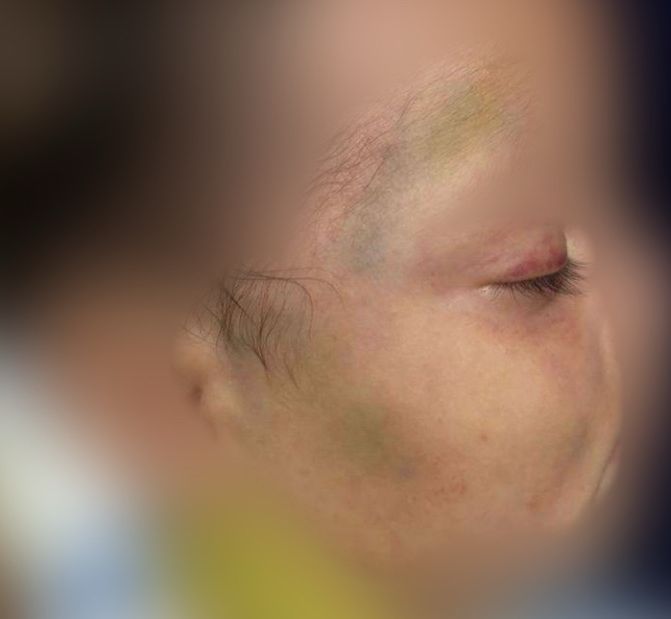 Foto: Divulga&ccedil;&atilde;o