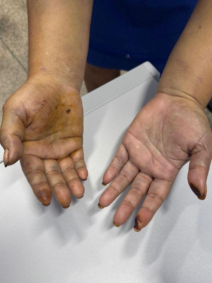 Mulher foi espancada por d&iacute;vida de R$ 3 / Foto: Divulga&ccedil;&atilde;o