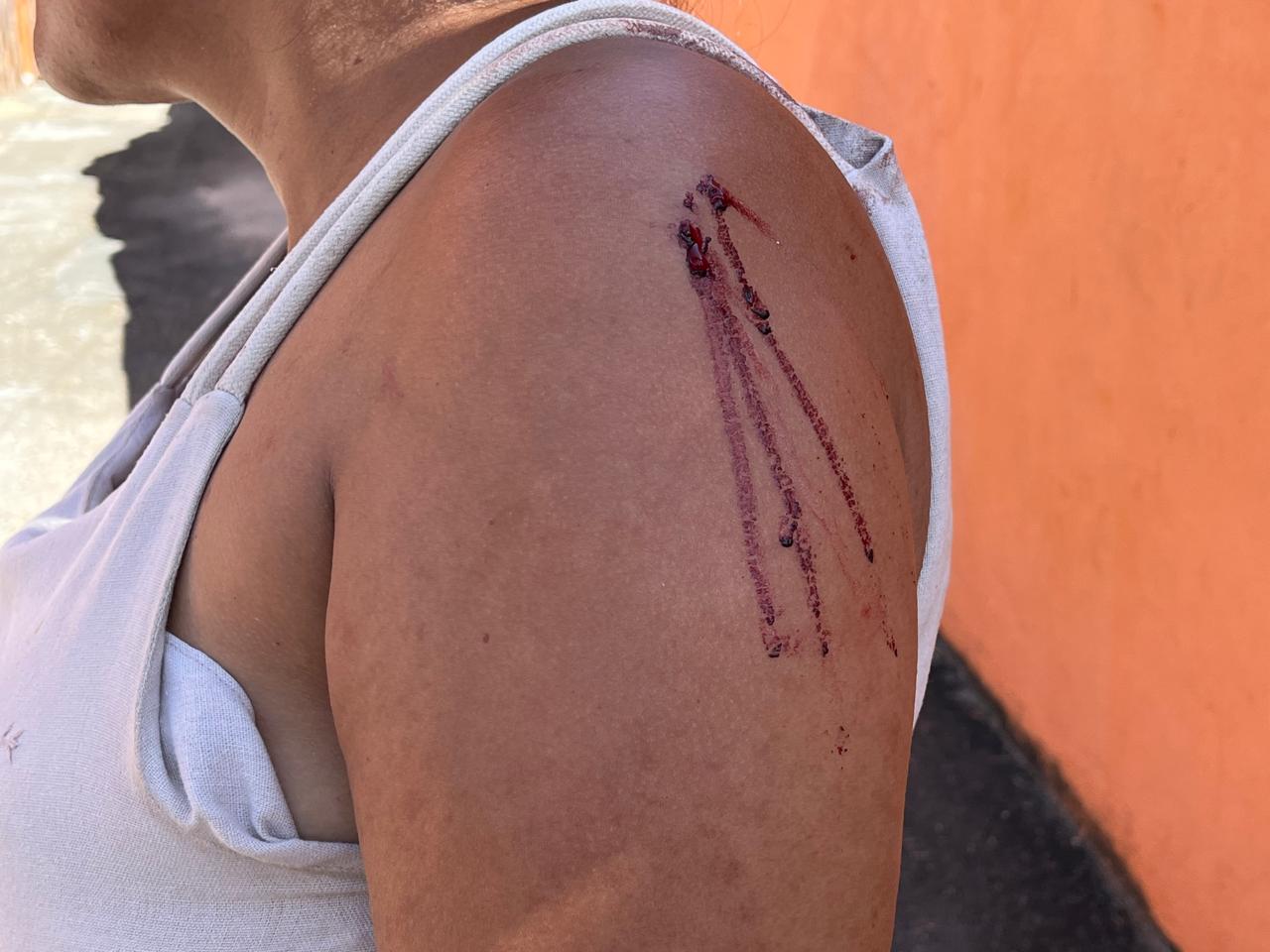 Mulher foi tentar ajudar v&iacute;tima e tamb&eacute;m foi ferida - Foto: Jander Robson/Portal do Holanda