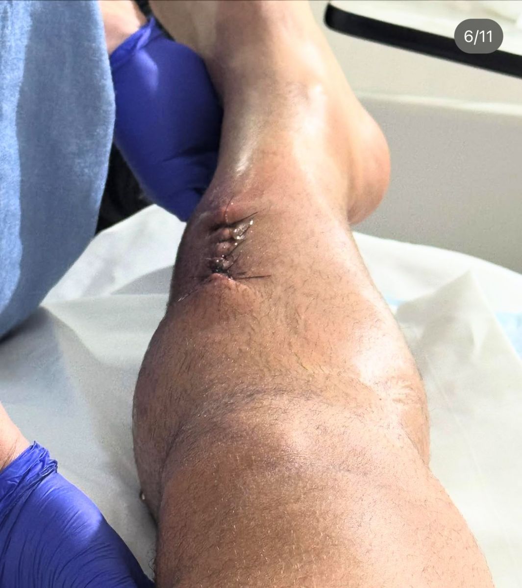 Foto: Reprodu&ccedil;&atilde;o/Instagram @vittorfernandes