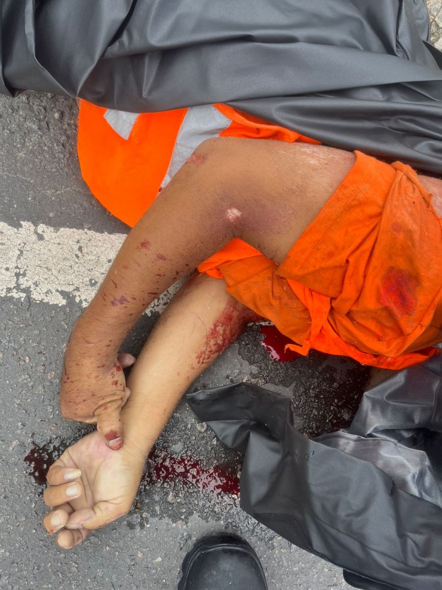 Isabela ficou bastante ferida - Foto: Divulga&ccedil;&atilde;o