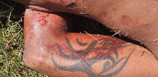 Foto: Neto Silva/Portal do Holanda