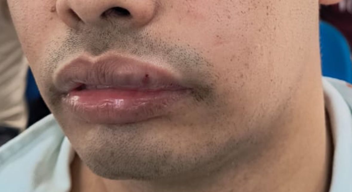 Um dos funcion&aacute;rios envolvidos na briga - foto: Divulga&ccedil;&atilde;o