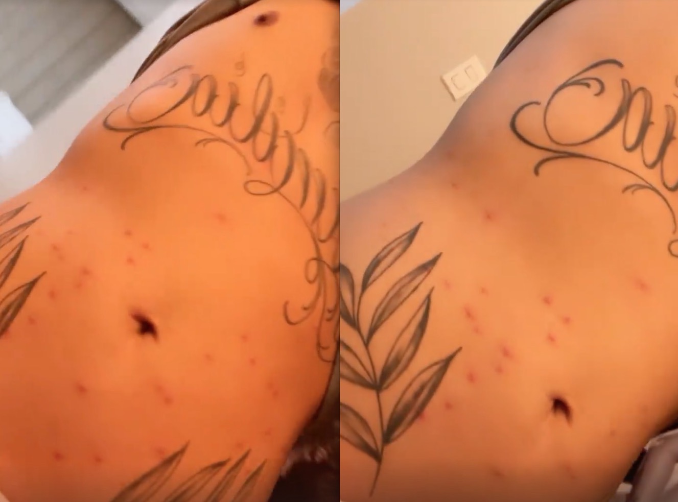 Corpo de Z&eacute; Felipe com manchas - Foto: Reprodu&ccedil;&atilde;o Instagram