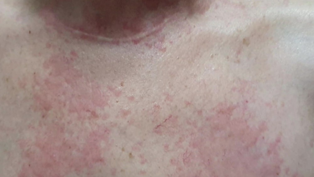 Foto: Reprodu&ccedil;&atilde;o/TV Globo