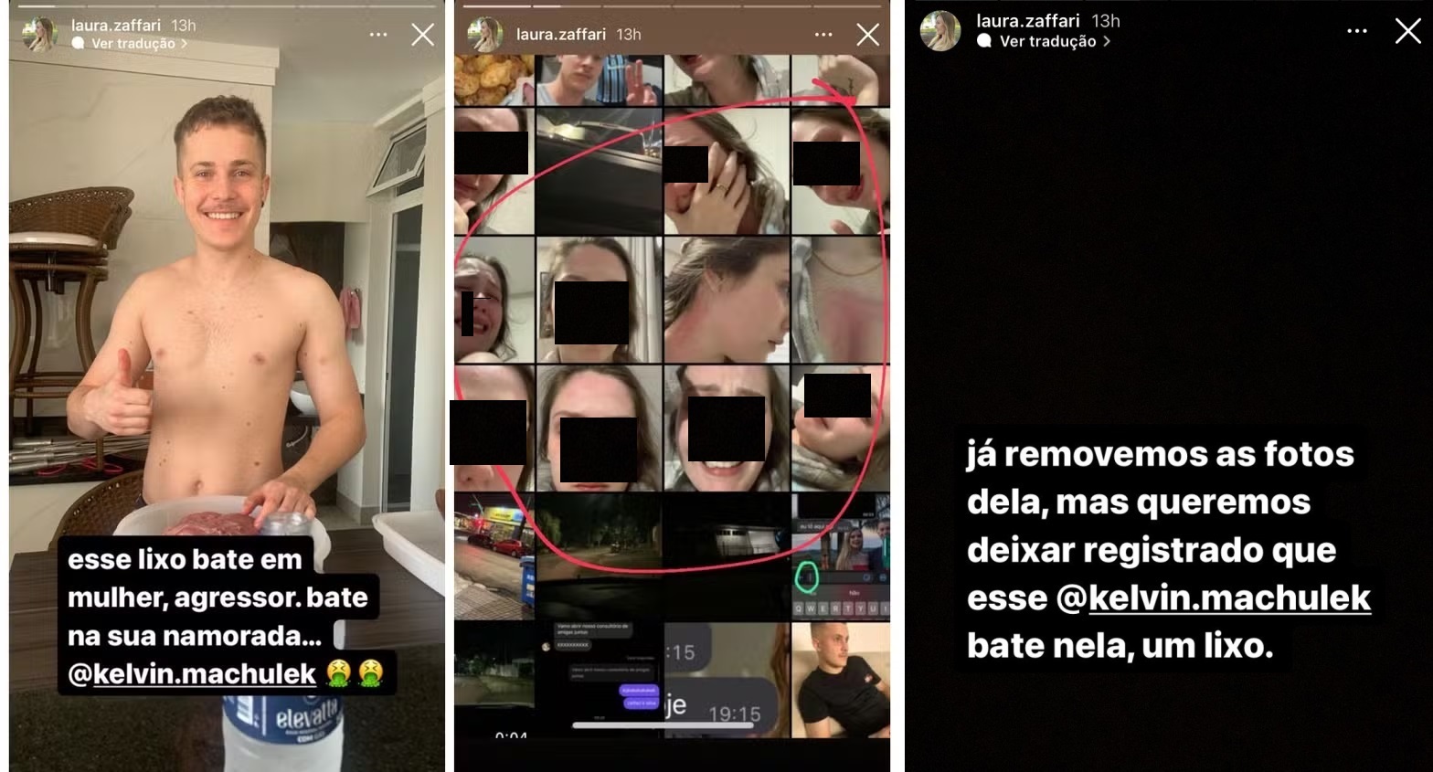 M&atilde;e da v&iacute;tima do furto afirma que a jovem sofreu alergia a shampoo e que criminosos est&atilde;o 'publicando mentiras'.