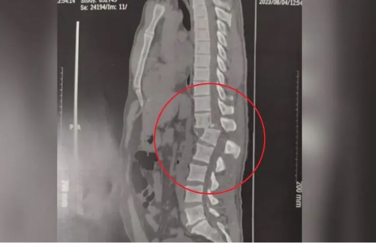 Foto: Divulga&ccedil;&atilde;o