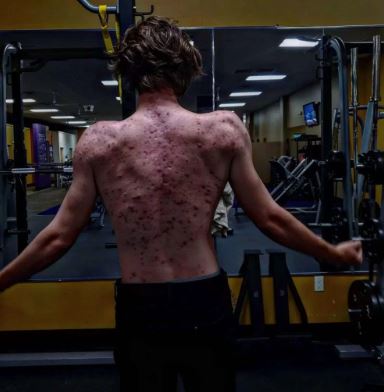 Foto: Reprodu&ccedil;&atilde;o/Instagram/ john_joshua_james