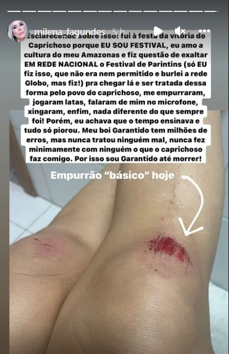 Foto: Reprodu&ccedil;&atilde;o/Instagram Milena Fagundes