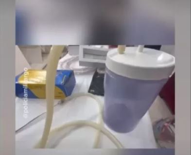 Copos descart&aacute;veis eram usados em equipamentos