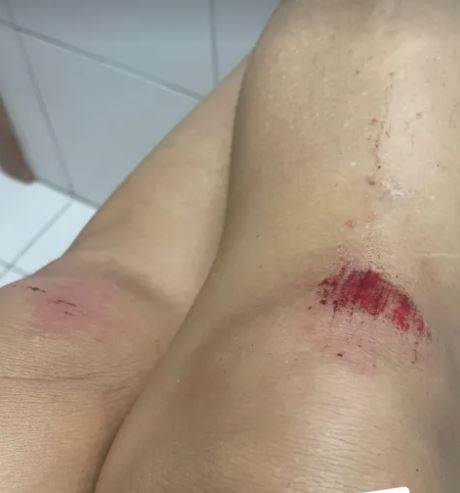 Foto: Reprodu&ccedil;&atilde;o/Instagram Milena Fagundes