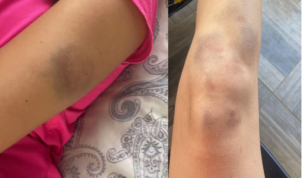 Foto: Reprodu&ccedil;&atilde;o 