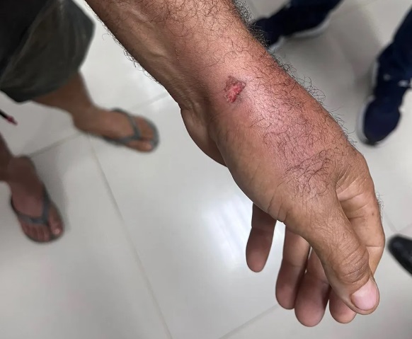 Foto: Divulga&ccedil;&atilde;o/PMRR