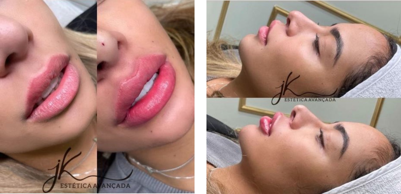 Foto: Reprodu&ccedil;&atilde;o Instagram