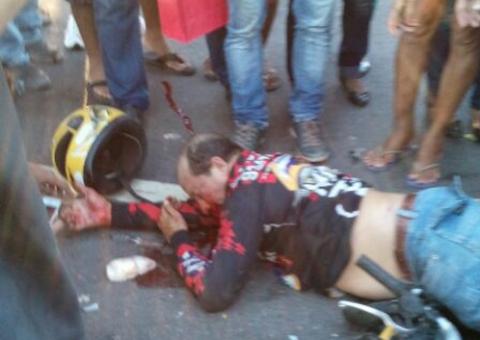 Micro-ônibus bate em moto e esmaga perna de rapaz