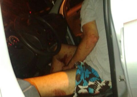 Homem é alvejado por tiros na Rua Pará