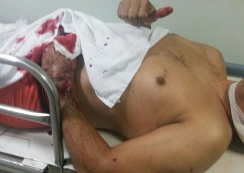  Soldado é ferido a facadas ao intervir em briga de casal