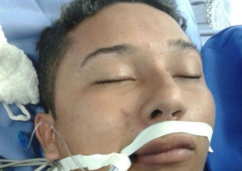 Troca tiros com polícia, foge e vai parar no hospital