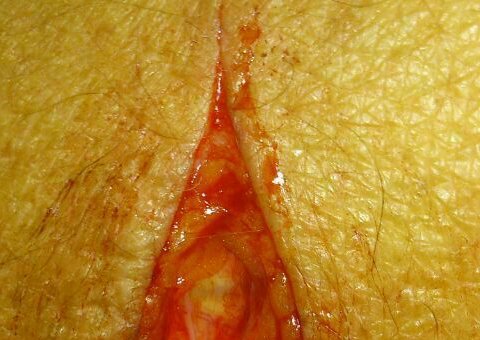 Aluno corta servidor de Ceti com estilete  