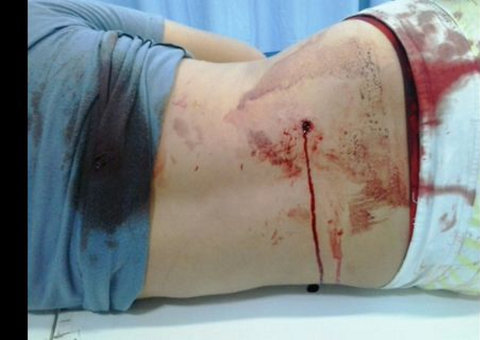  Menores baleados em tentativa de assalto