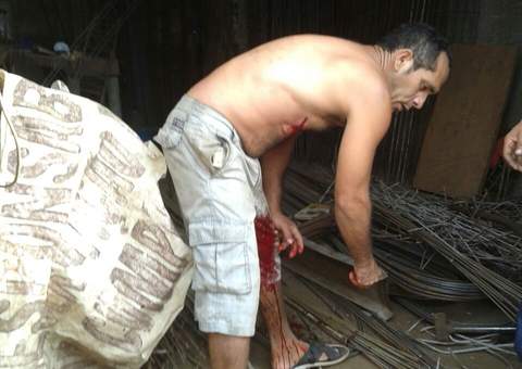 Pistoleiros tentam executar comerciante. Veja fotos