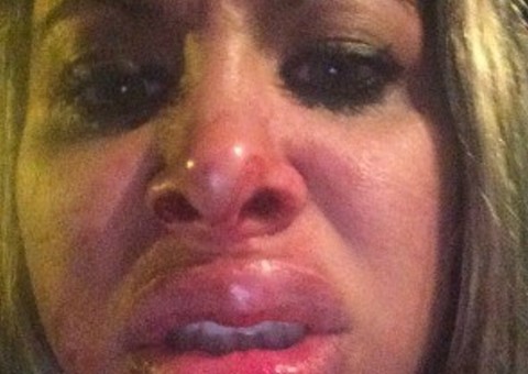 Ex-sedutora do Teste de Fidelidade que foi espancada por empresário vai pedir indenização