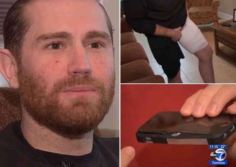 Iphone explode e deixa dono com queimaduras de terceiro grau