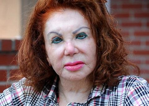  Mãe de Sylvester Stallone se arrepende de ter feito plásticas