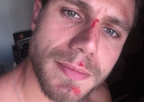 Ex-BBB é atropelado enquanto andava de bicicleta