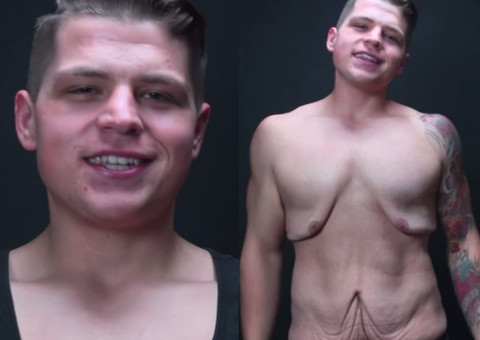 Jovem emagrece 72kg e mostra o resultado 