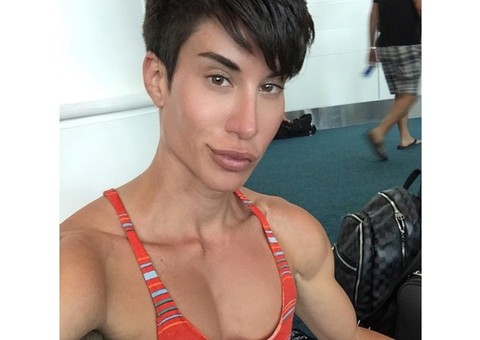  Ken Humano vai fazer cirurgia para implantar asas nas costas